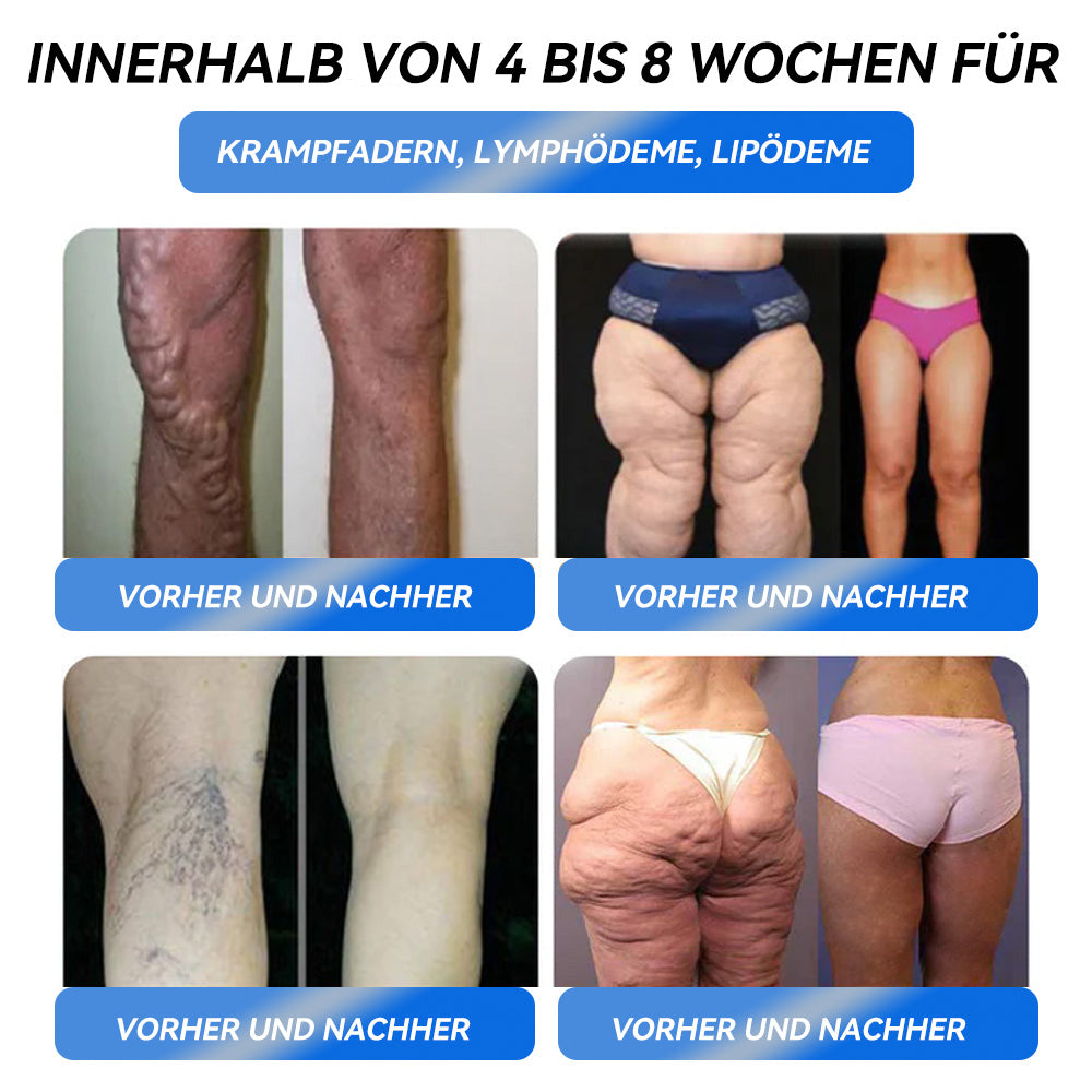 🍎Ourlyard® GLP-1 Pro Schlankheits-Trinklösung 7 Tage sichtbare Wirkung, keine Nebenwirkungen, geeignet für alle Altersgruppen 🌺🌺