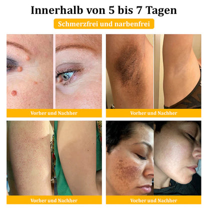 💥🌿🌿Turonu™ Bienengift-Mehrzweckcreme(👍✅Dermatest-Zertifizierung)