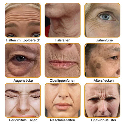 ✅👨‍⚕️BfArM-ZULASSUNG:Furzero™ Botox Hautbehandlung Cream