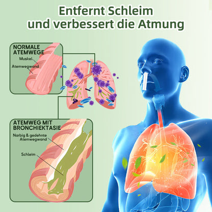 🍎Offizieller Shop|🔥Ourlyard™ Natürlicher Eukalyptus Lungenklar Inhalator 👨‍⚕️BfArM-certification(💝LETZTER TAG 50% RABATT 💝)