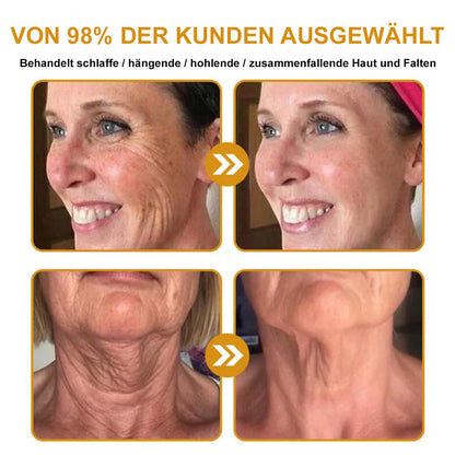 ✅👨‍⚕️BfArM-ZULASSUNG:Furzero™ Botox Hautbehandlung Cream