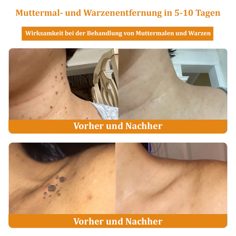 💥🌿🌿Turonu™ Bienengift-Mehrzweckcreme(👍✅Dermatest-Zertifizierung)