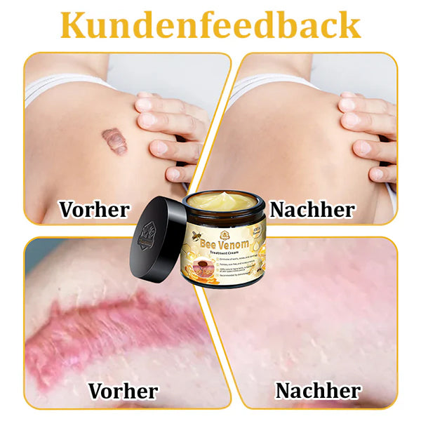 💥🌿🌿Turonu™ Bienengift-Mehrzweckcreme(👍✅Dermatest-Zertifizierung)